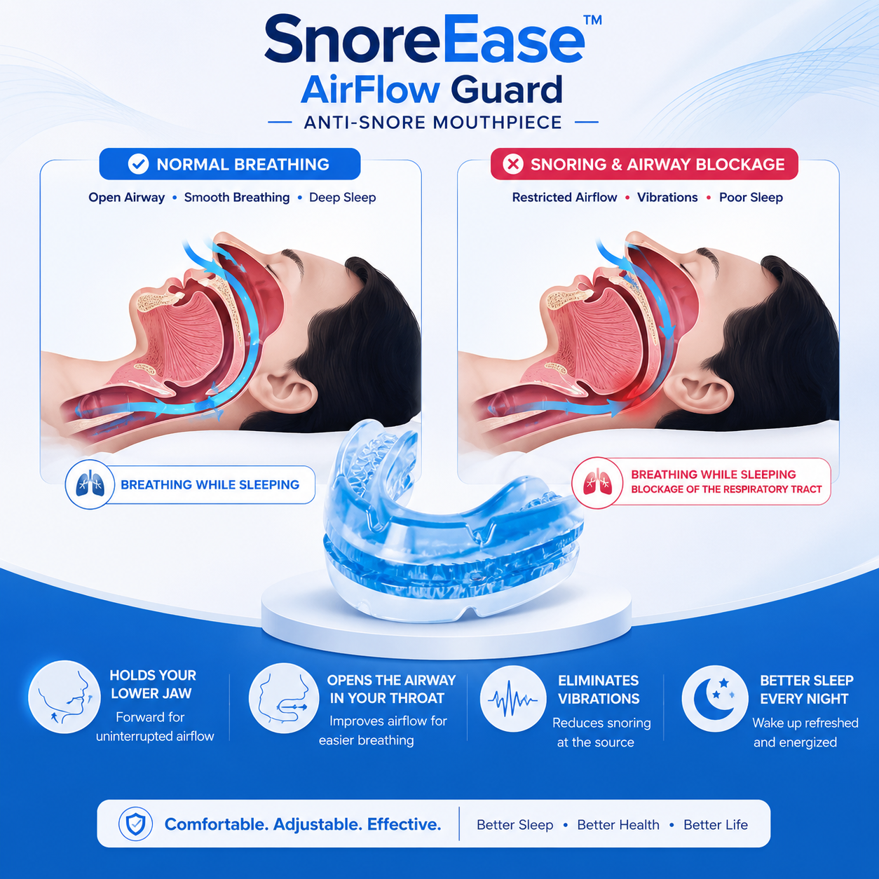 SnoreEase™ AirFlow Guard